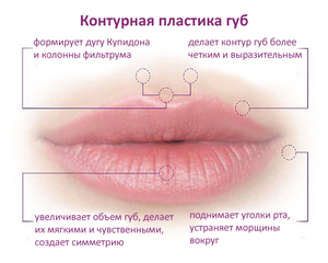 Контурная пластика губ Контурная пластика губ