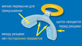 Stoppi Stoppi