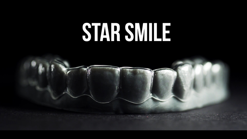 Видео об элайнерах Star Smile