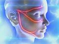 Особенности ЛФК при неврите лицевого нерва